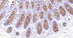 MUC2 Recombinant Rabbit Monoclonal Antibody (7F9)