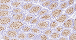MUC2 Antibody in Immunohistochemistry (Paraffin) (IHC (P))