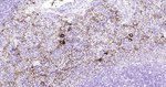 CD42b Antibody in Immunohistochemistry (Paraffin) (IHC (P))