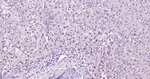 Arginase 1 Antibody in Immunohistochemistry (Paraffin) (IHC (P))