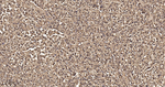Arginase 1 Antibody in Immunohistochemistry (Paraffin) (IHC (P))