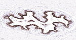 Cytokeratin 7 Antibody in Immunohistochemistry (Paraffin) (IHC (P))