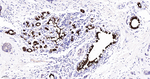 Cytokeratin 7 Antibody in Immunohistochemistry (Paraffin) (IHC (P))