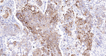 Cytokeratin 7 Antibody in Immunohistochemistry (Paraffin) (IHC (P))