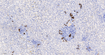 Cytokeratin 7 Antibody in Immunohistochemistry (Paraffin) (IHC (P))
