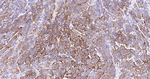 Cytokeratin 7 Antibody in Immunohistochemistry (Paraffin) (IHC (P))