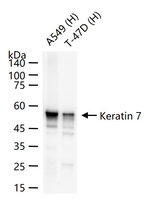 Cytokeratin 7 Antibody in Western Blot (WB)