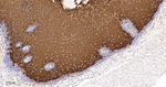 Cytokeratin 4 Antibody in Immunohistochemistry (Paraffin) (IHC (P))