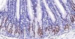 MSH6 Antibody in Immunohistochemistry (Paraffin) (IHC (P))
