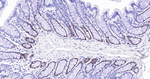 MSH6 Antibody in Immunohistochemistry (Paraffin) (IHC (P))