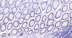 MSH6 Antibody in Immunohistochemistry (Paraffin) (IHC (P))