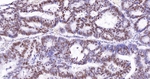MSH6 Antibody in Immunohistochemistry (Paraffin) (IHC (P))