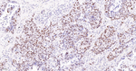 MSH6 Antibody in Immunohistochemistry (Paraffin) (IHC (P))