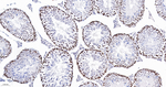 MSH6 Antibody in Immunohistochemistry (Paraffin) (IHC (P))