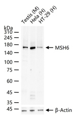 MSH6 Antibody in Western Blot (WB)