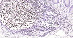 PAX5 Antibody in Immunohistochemistry (Paraffin) (IHC (P))