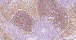 PAX5 Antibody in Immunohistochemistry (Paraffin) (IHC (P))