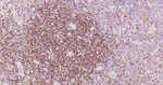 PAX5 Antibody in Immunohistochemistry (Paraffin) (IHC (P))