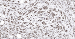 MSH2 Antibody in Immunohistochemistry (Paraffin) (IHC (P))