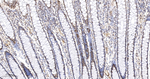 MSH2 Antibody in Immunohistochemistry (Paraffin) (IHC (P))