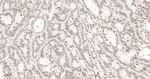 MSH2 Antibody in Immunohistochemistry (Paraffin) (IHC (P))