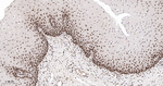 MSH2 Antibody in Immunohistochemistry (Paraffin) (IHC (P))