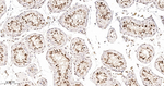 MSH2 Antibody in Immunohistochemistry (Paraffin) (IHC (P))