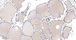 MSH2 Antibody in Immunohistochemistry (Paraffin) (IHC (P))