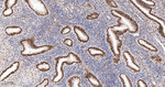 MSH2 Antibody in Immunohistochemistry (Paraffin) (IHC (P))