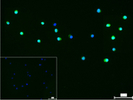 BCL6 Recombinant Rabbit Monoclonal Antibody (C4E12)