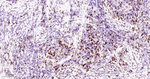 CD103 Antibody in Immunohistochemistry (Paraffin) (IHC (P))