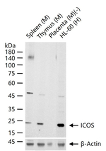 ICOS Antibody in Western Blot (WB)