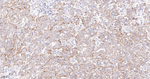 delta Catenin Antibody in Immunohistochemistry (Paraffin) (IHC (P))