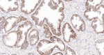 delta Catenin Recombinant Rabbit Monoclonal Antibody (G11E8)