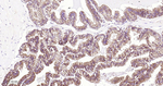 delta Catenin Antibody in Immunohistochemistry (Paraffin) (IHC (P))