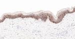 delta Catenin Antibody in Immunohistochemistry (Paraffin) (IHC (P))