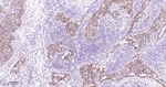 delta Catenin Antibody in Immunohistochemistry (Paraffin) (IHC (P))