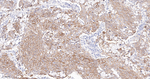 delta Catenin Antibody in Immunohistochemistry (Paraffin) (IHC (P))