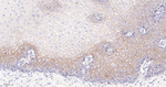 delta Catenin Antibody in Immunohistochemistry (Paraffin) (IHC (P))