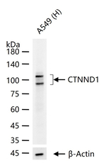 delta Catenin Antibody in Western Blot (WB)