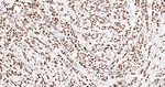 ERCC1 Antibody in Immunohistochemistry (Paraffin) (IHC (P))