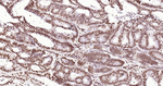 ERCC1 Antibody in Immunohistochemistry (Paraffin) (IHC (P))