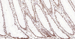 ERCC1 Antibody in Immunohistochemistry (Paraffin) (IHC (P))