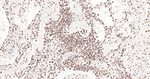 ERCC1 Antibody in Immunohistochemistry (Paraffin) (IHC (P))
