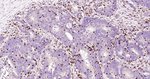 CD7 Antibody in Immunohistochemistry (Paraffin) (IHC (P))