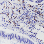 CD7 Recombinant Rabbit Monoclonal Antibody (B2D9)