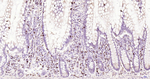 CD7 Antibody in Immunohistochemistry (Paraffin) (IHC (P))