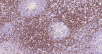 CD7 Antibody in Immunohistochemistry (Paraffin) (IHC (P))