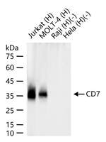 CD7 Antibody in Western Blot (WB)