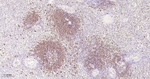 CD22 Antibody in Immunohistochemistry (Paraffin) (IHC (P))